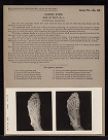 Lower Limb. Sole of Foot - no. 1